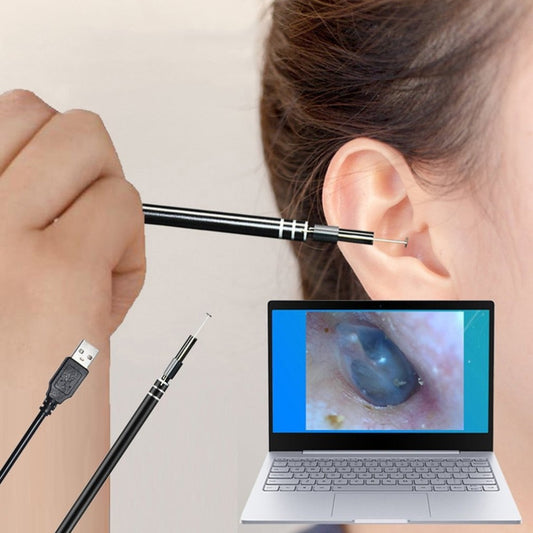 Visual Ear Pick Ear Canal Endoscope